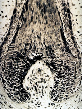 FOLLICOLO