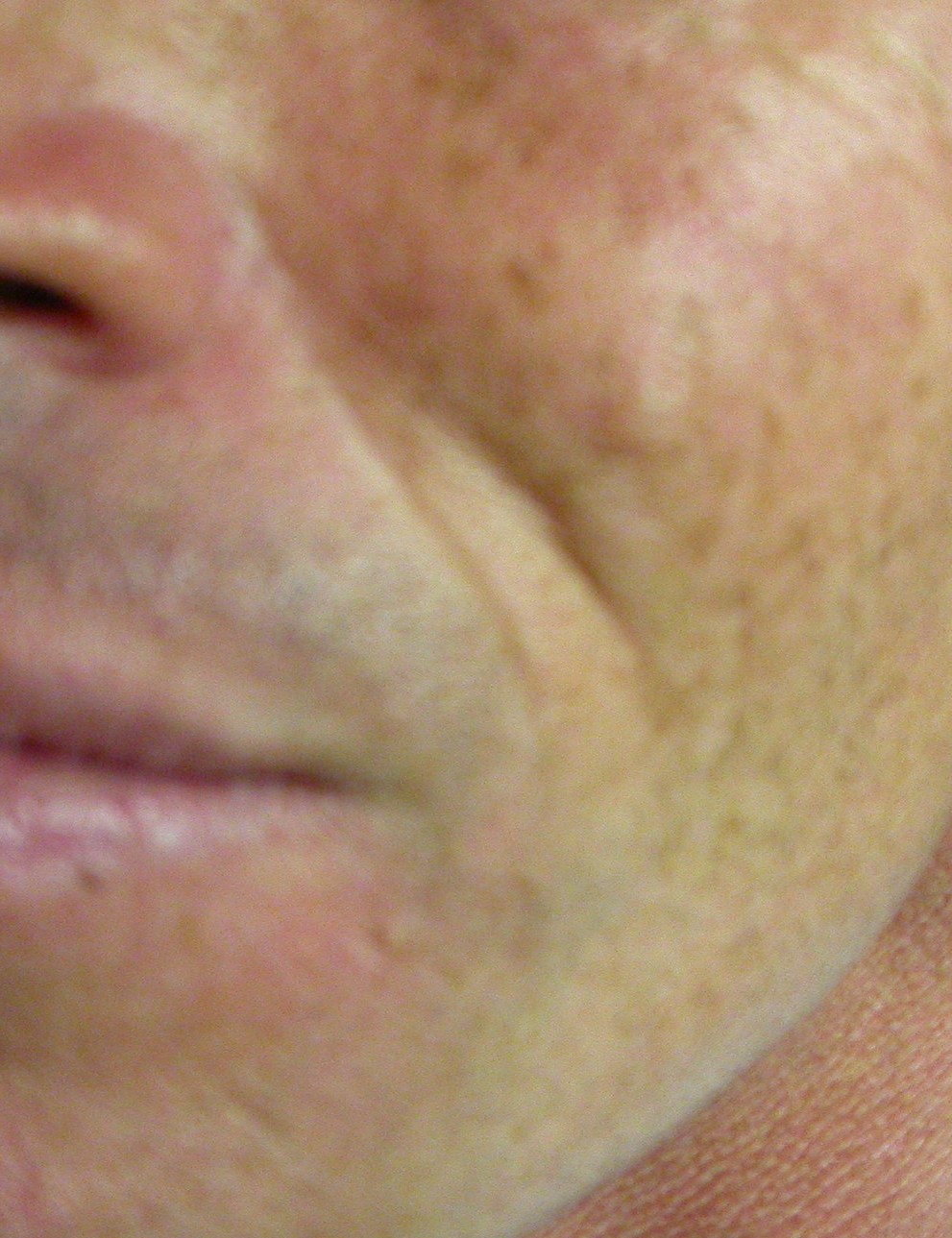 prima2